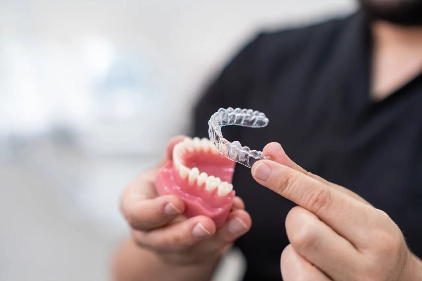 Clear Aligners (Non-Invisalign Options)