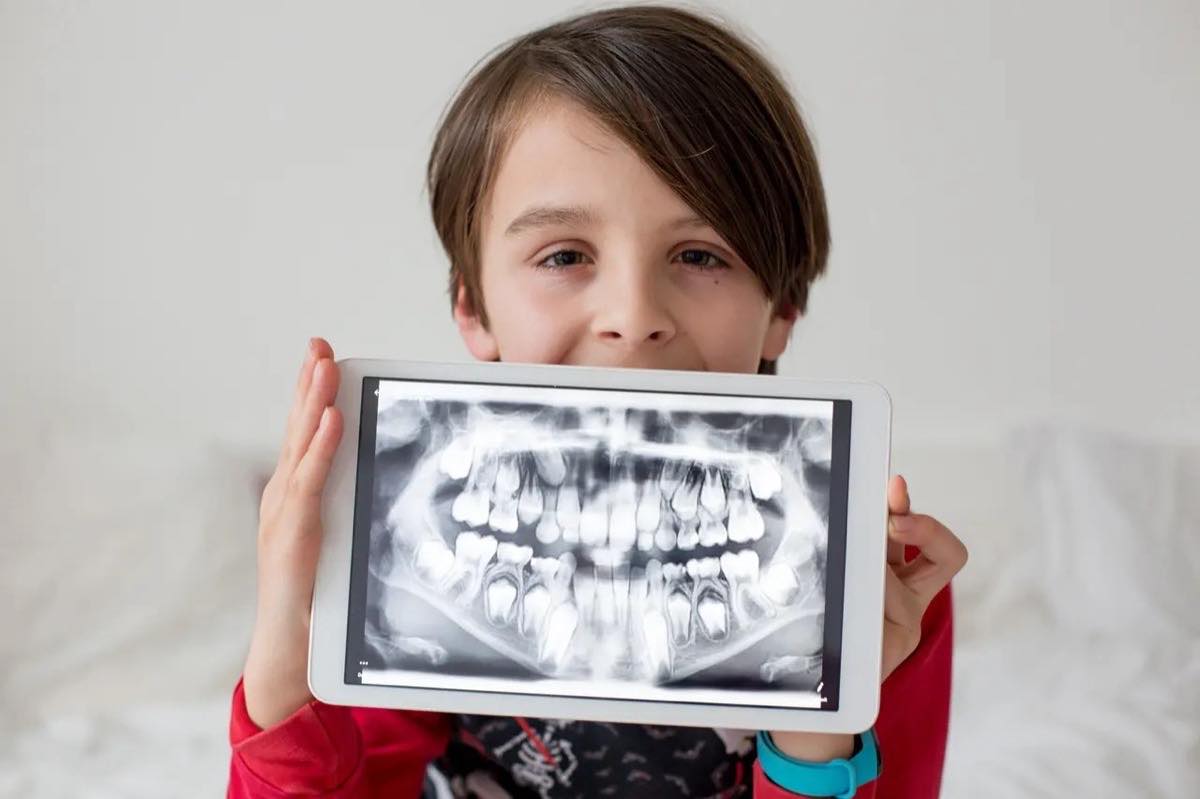 Digital X-Rays / Imaging at Dynamic Dental in Bluefield, WV