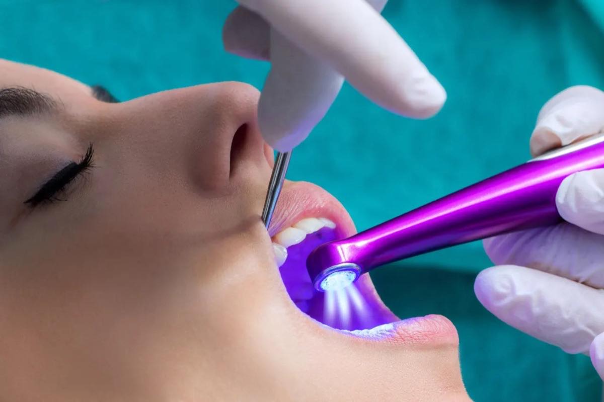Sealants at Dynamic Dental in Bluefield, WV